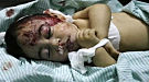 اصابة 17 فلسطينيا بينهم 7 اطفال وسيدتان في هجوم صهيوني علي غزة